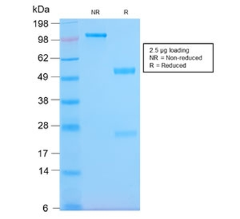 Pan-HLA Antibody (DP/DQ/DR)