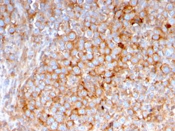 SERBP1 Antibody / PAI-RBP1