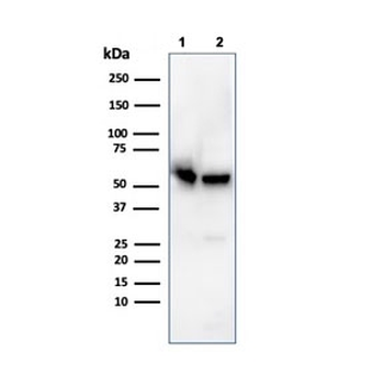 SERBP1 Antibody / PAI-RBP1