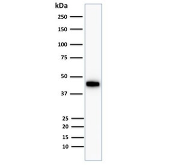 Cytokeratin 18 Antibody Cocktail