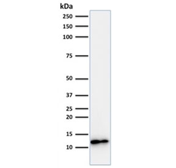 Recombinant B2M Antibody / Beta-2 Microglobulin