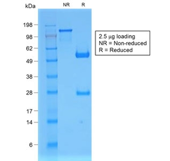 Recombinant B2M Antibody / Beta-2 Microglobulin