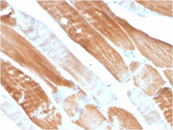 ACTN2 Antibody / Alpha Actinin 2 / Sarcomeric Alpha Actinin