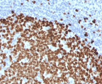 Thymidylate Synthase Antibody