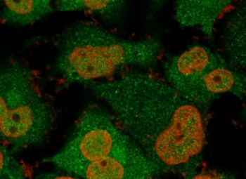 Recombinant UchL1 Antibody
