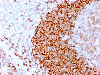 Recombinant CD79b Antibody