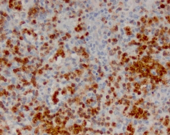 ANXA1 Antibody / Annexin A1