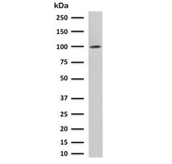 FOLH1 Antibody / PSMA