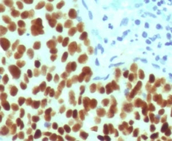 Recombinant SOX2 Antibody