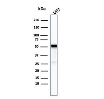 Beta Tubulin Antibody / TUBB3