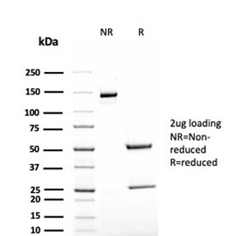 Recombinant TAG-72 Antibody