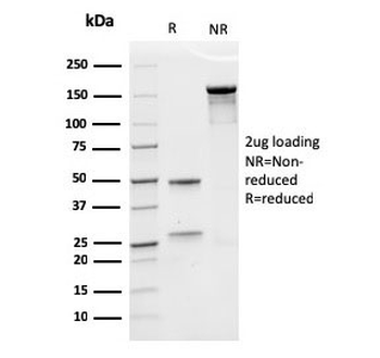 Recombinant Erythropoietin Antibody / EPO