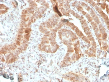 Recombinant AKT1 Antibody