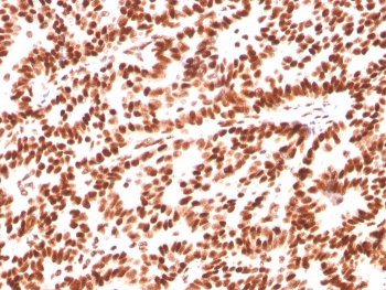 Estrogen Receptor alpha Antibody