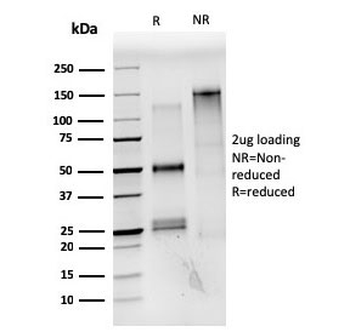 Estrogen Receptor alpha Antibody