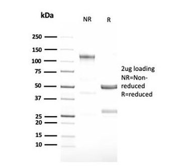 Recombinant GCSF Antibody / Granulocyte-Colony Stimulating Factor