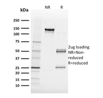 FABP5 Antibody