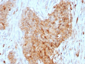Glucose 6-Phosphate Isomerase Antibody / GPI