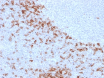 Human IgD Antibody / Heavy chain