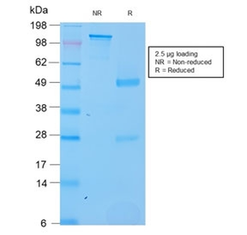 Recombinant SOX2 Antibody