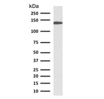 CDH17 Antibody / Cadherin 17