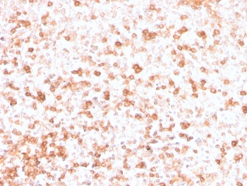 Recombinant Lambda Light Chain Antibody