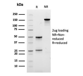 Recombinant Lambda Light Chain Antibody