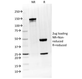 Interleukin 4 Antibody / IL-4