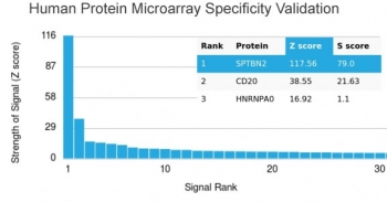 Recombinant Spectrin beta III Antibody / SPTBN2