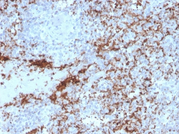 Recombinant ITGB3 Antibody / Integrin beta 3 / CD61