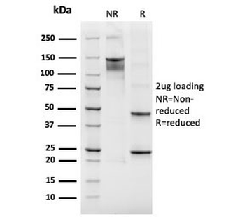 Recombinant ITGB3 Antibody / Integrin beta 3 / CD61