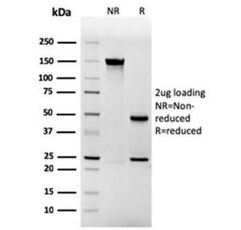 Recombinant Involucrin Antibody
