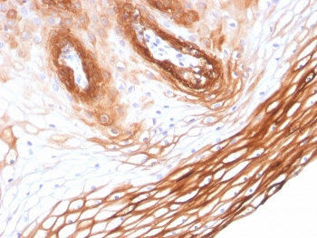 Cytokeratin 14 Antibody / KRT14