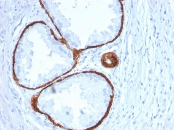 Cytokeratin 14 Antibody / KRT14
