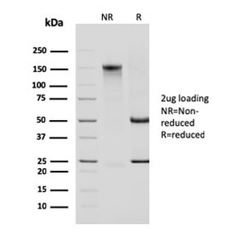 Cytokeratin 14 Antibody / KRT14
