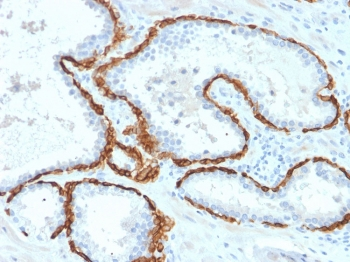 Keratin 15 Antibody / Cytokeratin 15