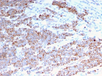 Recombinant Cytokeratin 18 Antibody