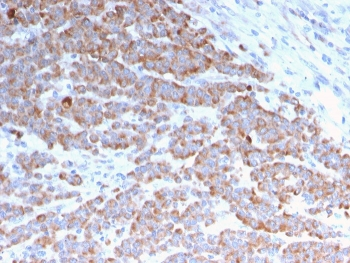 Recombinant Cytokeratin 18 Antibody