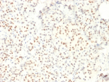 LMO2 Antibody / Rhombotin 2