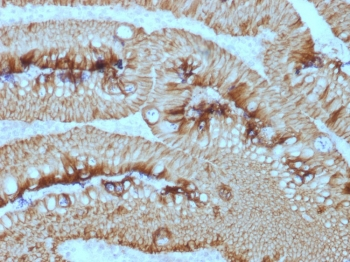 EpCAM Antibody