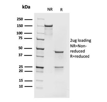 Recombinant MCM7 Antibody