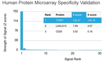 TRP1 / Tyrosinase-Related Protein-1 Antibody / TYRP1