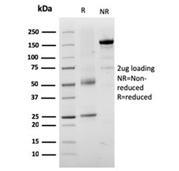 TRP1 / Tyrosinase-Related Protein-1 Antibody / TYRP1