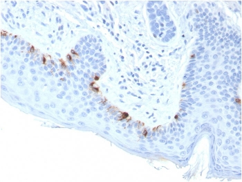 TRP1 / Tyrosinase-Related Protein-1 Antibody / TYRP1