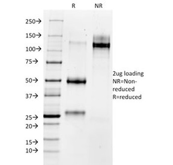 MMP3 Antibody / Matrix Metalloproteinase 3