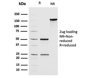 MSH2 Antibody