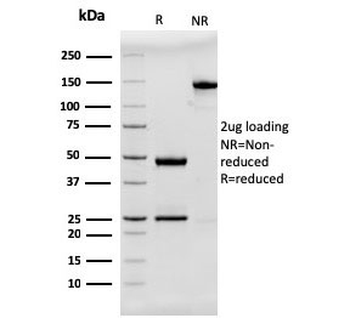 Recombinant MUC2 Antibody / Mucin 2