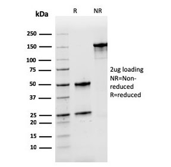 Recombinant Nucleophosmin Antibody / NPM1