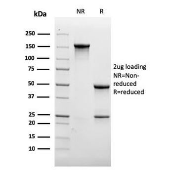 Recombinant CD31 Antibody / PECAM-1