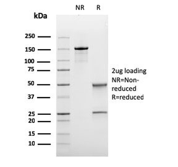 Recombinant Bcl6 Antibody